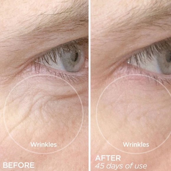 NIB BeautyBio R45 The Reversal Skincare Treatment - Picture 6 of 7